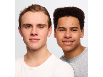 Pimple patch Men